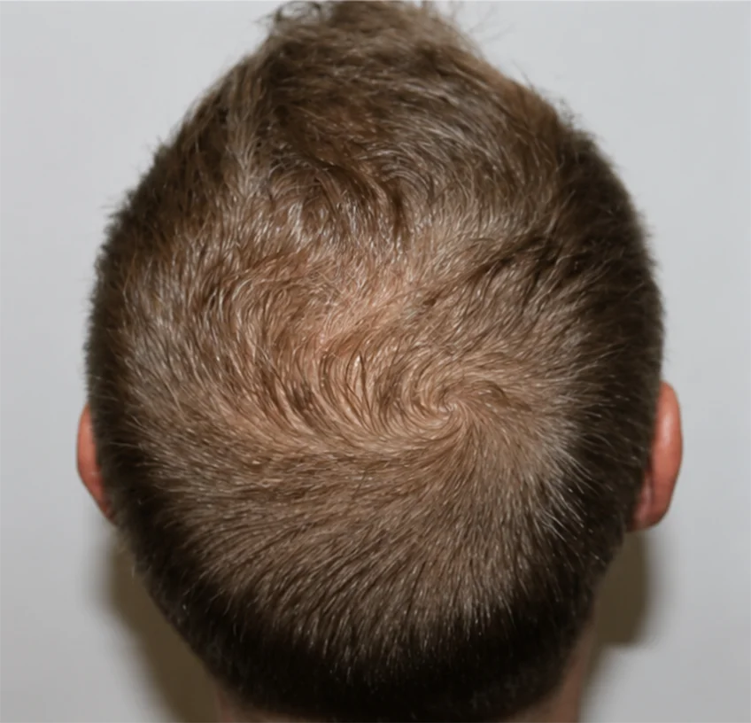 Before Image