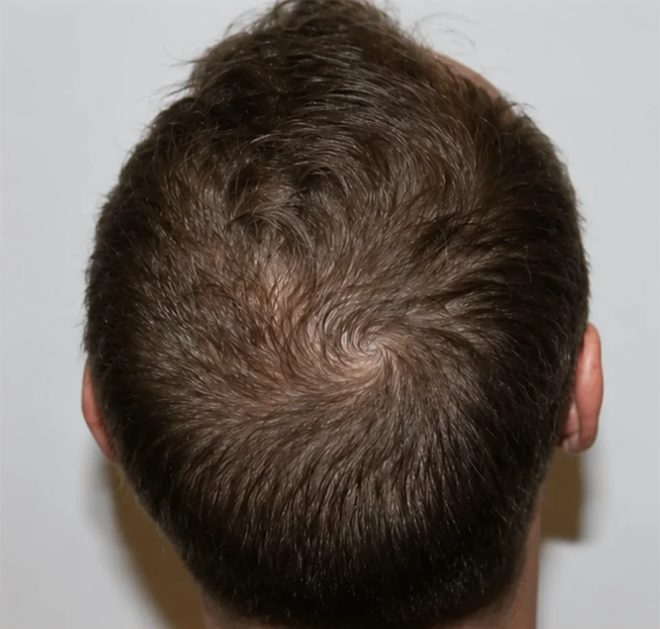 After Image