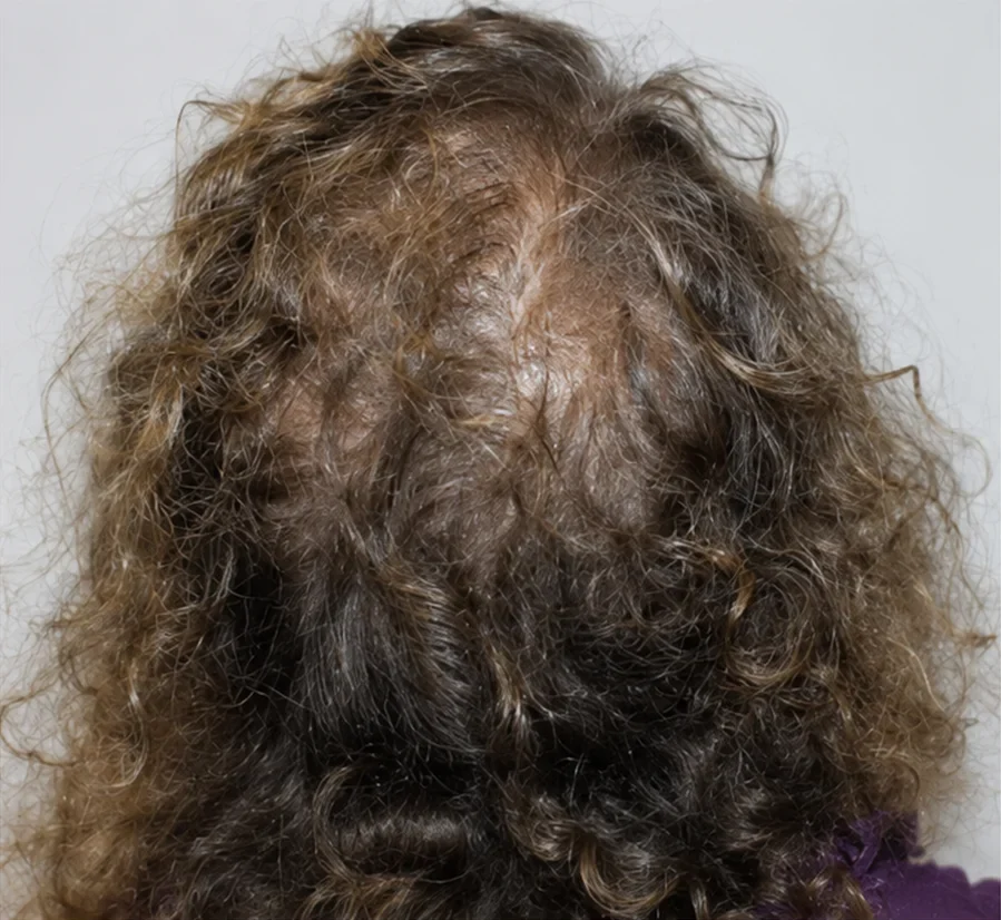 Before Image
