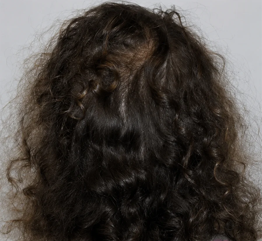 After Image