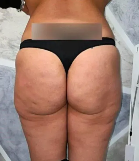Before Image