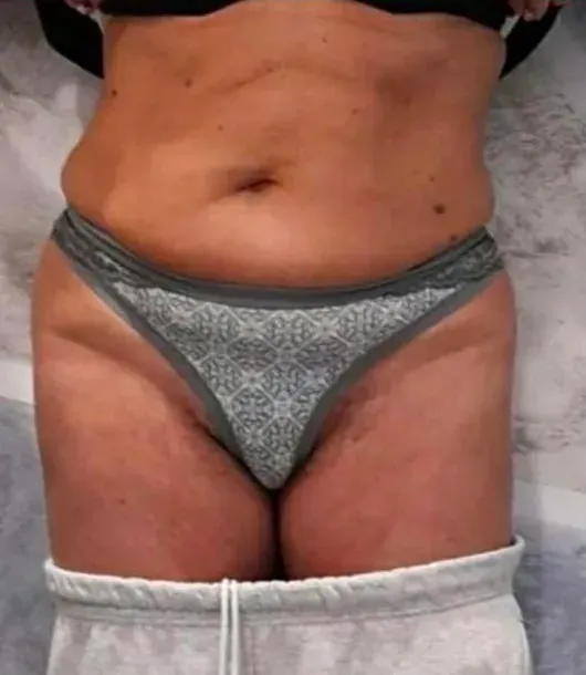 Before Image