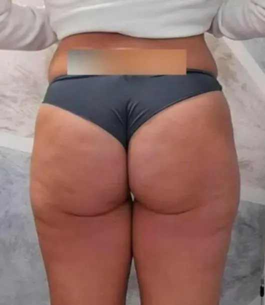 After Image