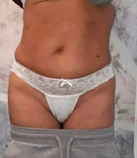 After Image