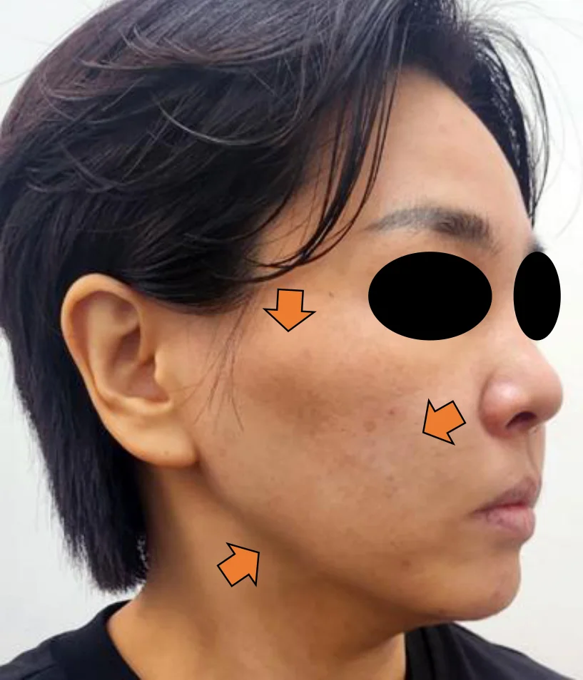 After Image