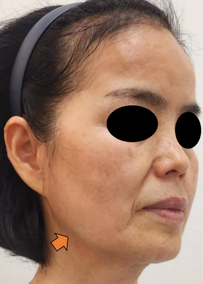 After Image