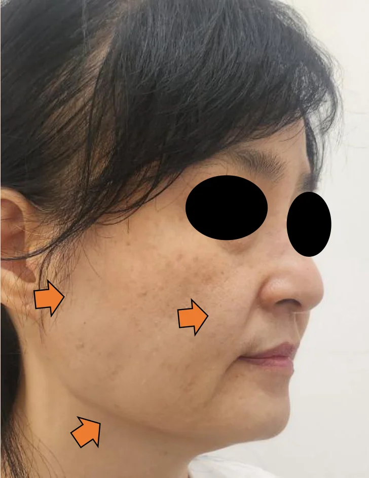 Before Image