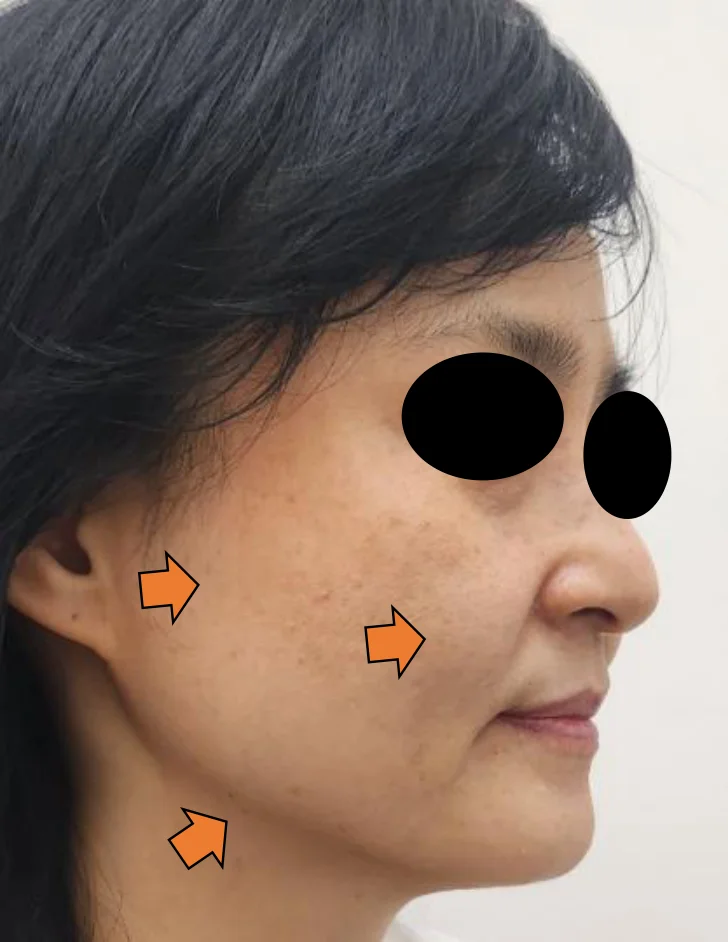 After Image